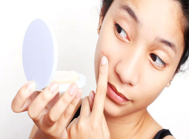 20 Best Ways to Prevent Acne(pimples) - Online Aushadhi , Health Tips